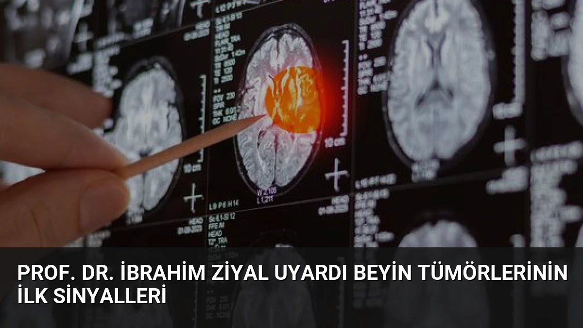 Prof. Dr. İbrahim Ziyal Uyardı Beyin Tümörlerinin İlk Sinyalleri