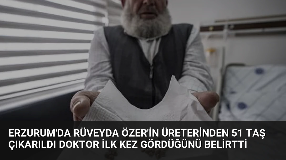 Erzurum’da Rüveyda Özer’in Üreterinden 51 Taş Çıkarıldı Doktor İlk Kez Gördüğünü Belirtti