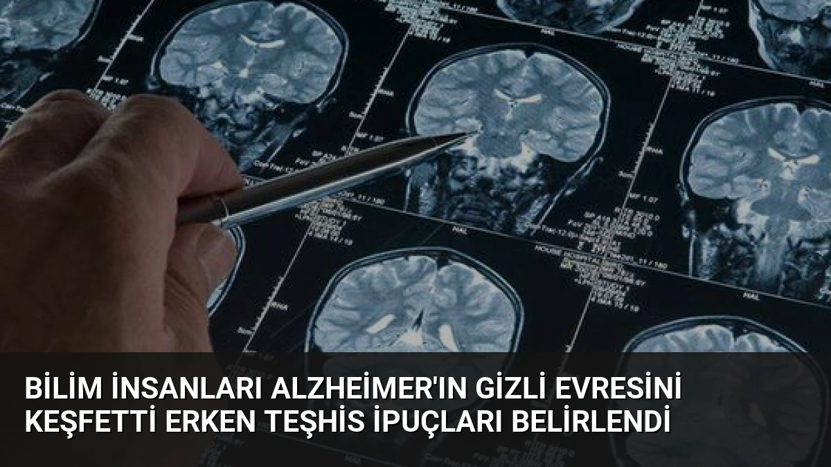 Bilim İnsanları Alzheimer’ın Gizli Evresini Keşfetti Erken Teşhis İpuçları Belirlendi