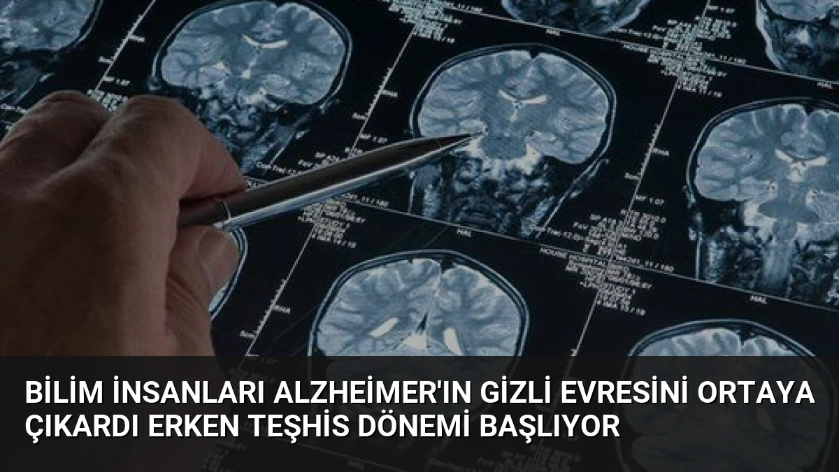 Bilim İnsanları Alzheimer’ın Gizli Evresini Ortaya Çıkardı Erken Teşhis Dönemi Başlıyor