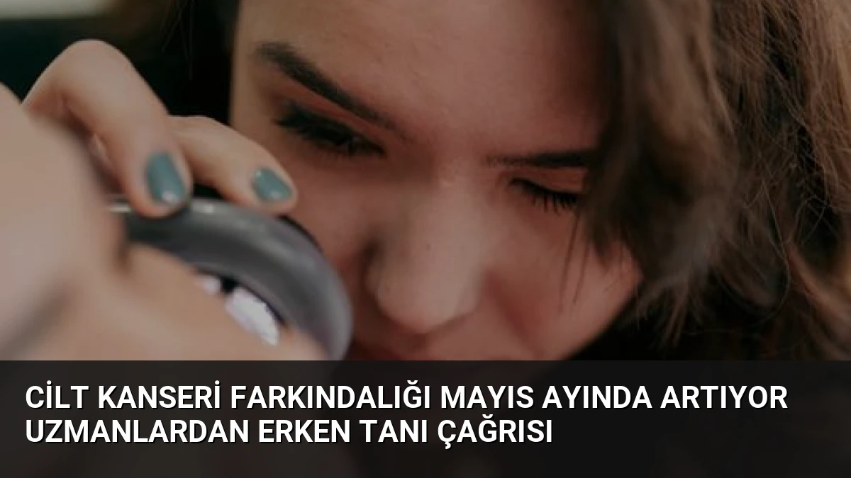 Cilt Kanseri Farkındalığı Mayıs Ayında Artıyor Uzmanlardan Erken Tanı Çağrısı