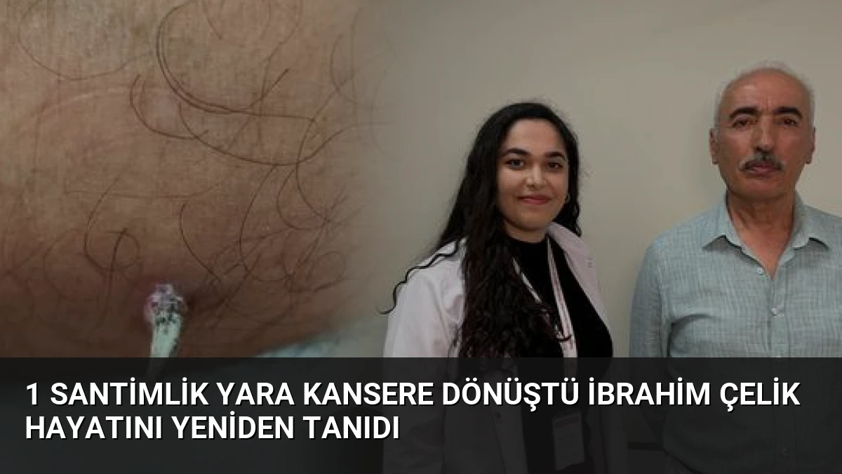 1 Santimlik Yara Kansere Dönüştü İbrahim Çelik Hayatını Yeniden Tanıdı